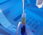 hbv-dna������ձ�����